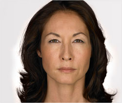 Angela 14 days after