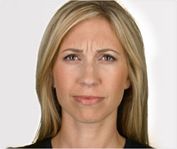 Tina before her Botox treatment