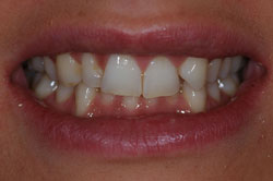 Before
